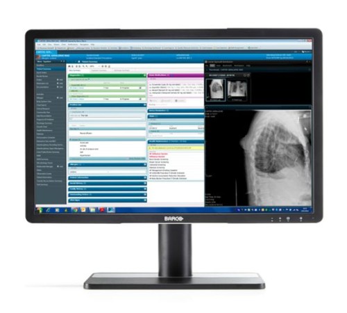 Barco Eonis 22" (MDRC-2222 Option BL) Barco Eonis 22" (MDRC-2222 Option BL)